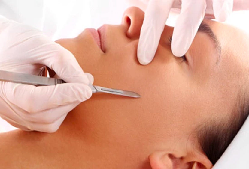 All About Dermaplaning