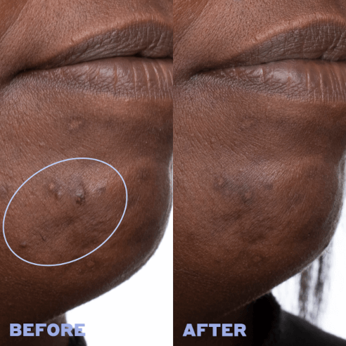 Volition Beauty Skin Rhythm™️ Balancing & Clearing Serum