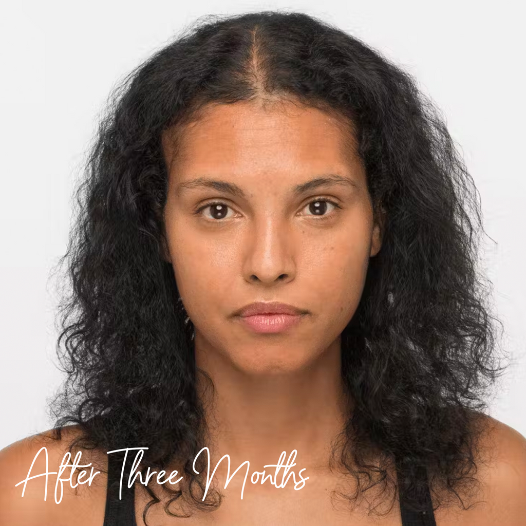 NEW✨ Nutrafol Vegan Women Hair Growth Pack (Ages 18-44)