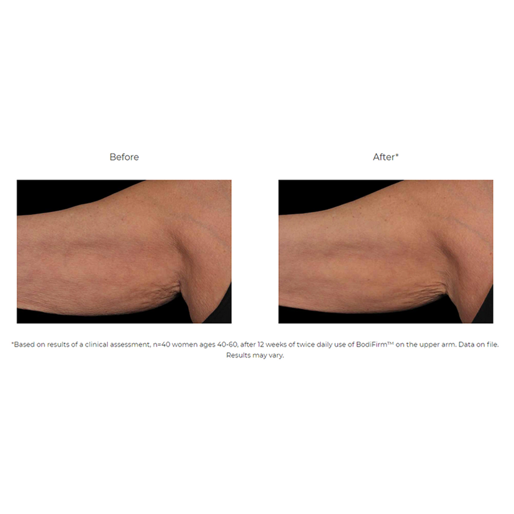 
                
                    Load image into Gallery viewer, Revision BodiFirm Body Contouring Lotion
                
            