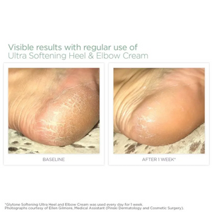 
                
                    Load image into Gallery viewer, Glytone Ultra Softening Heel and Elbow Cream 50ml
                
            